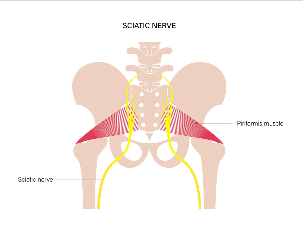 Pilates for Sciatica – How it can help - optimised shutterstock 1931232020